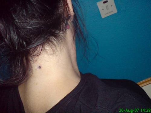 Nape