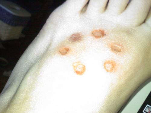 <img500*375:stuff/time_to_heal.jpg>